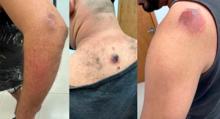 Vídeo – Preso por ajudar em fuga diz que apanhou de policiais