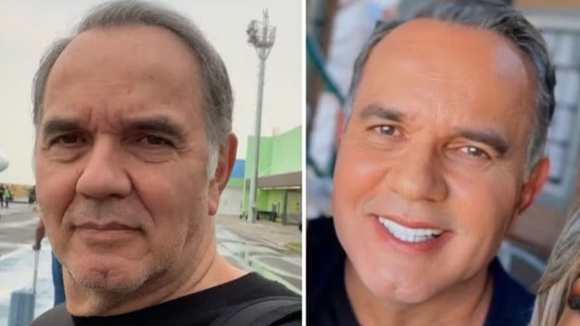 Humberto Martins celebra harmonização facial: ‘Estava preocupado’