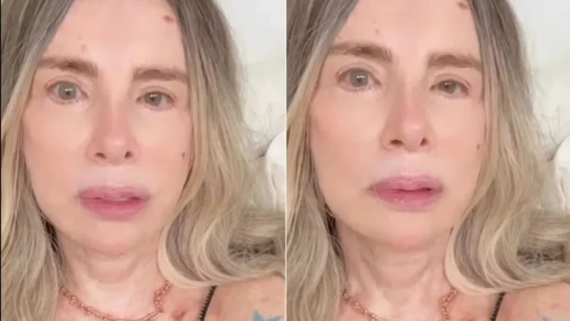Isis de Oliveira faz nova cirurgia e revela: ‘Luma não me liga’