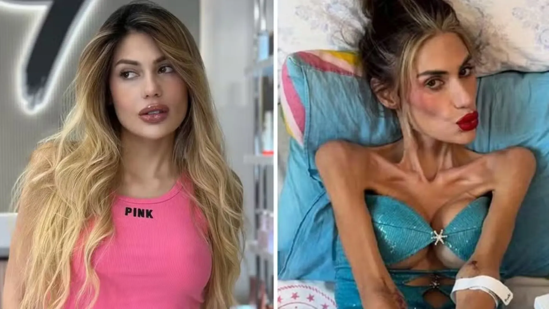 Influencer morre aos 30 anos após luta contra distúrbio alimentar