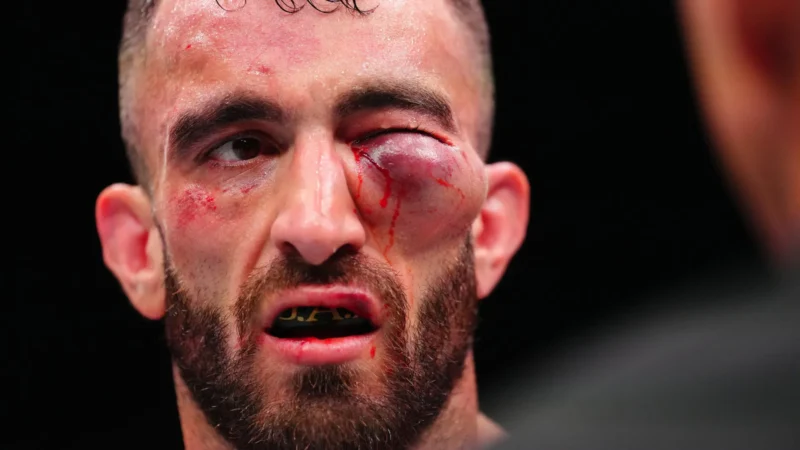 Lutador perde no UFC e tem rosto desfigurado; imagem é forte