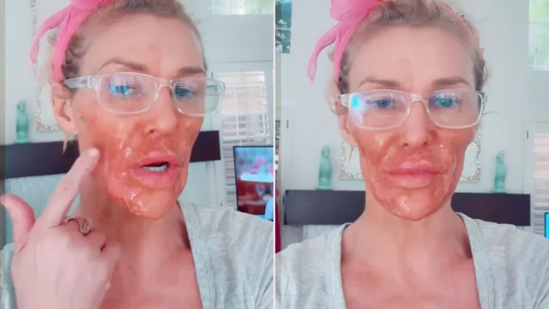 Ex-modelo Brandi Glanville mostra novo rosto após iniciar tratamento