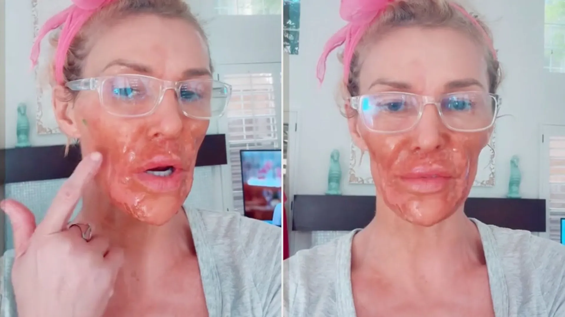 Ex-modelo Brandi Glanville mostra novo rosto após iniciar tratamento