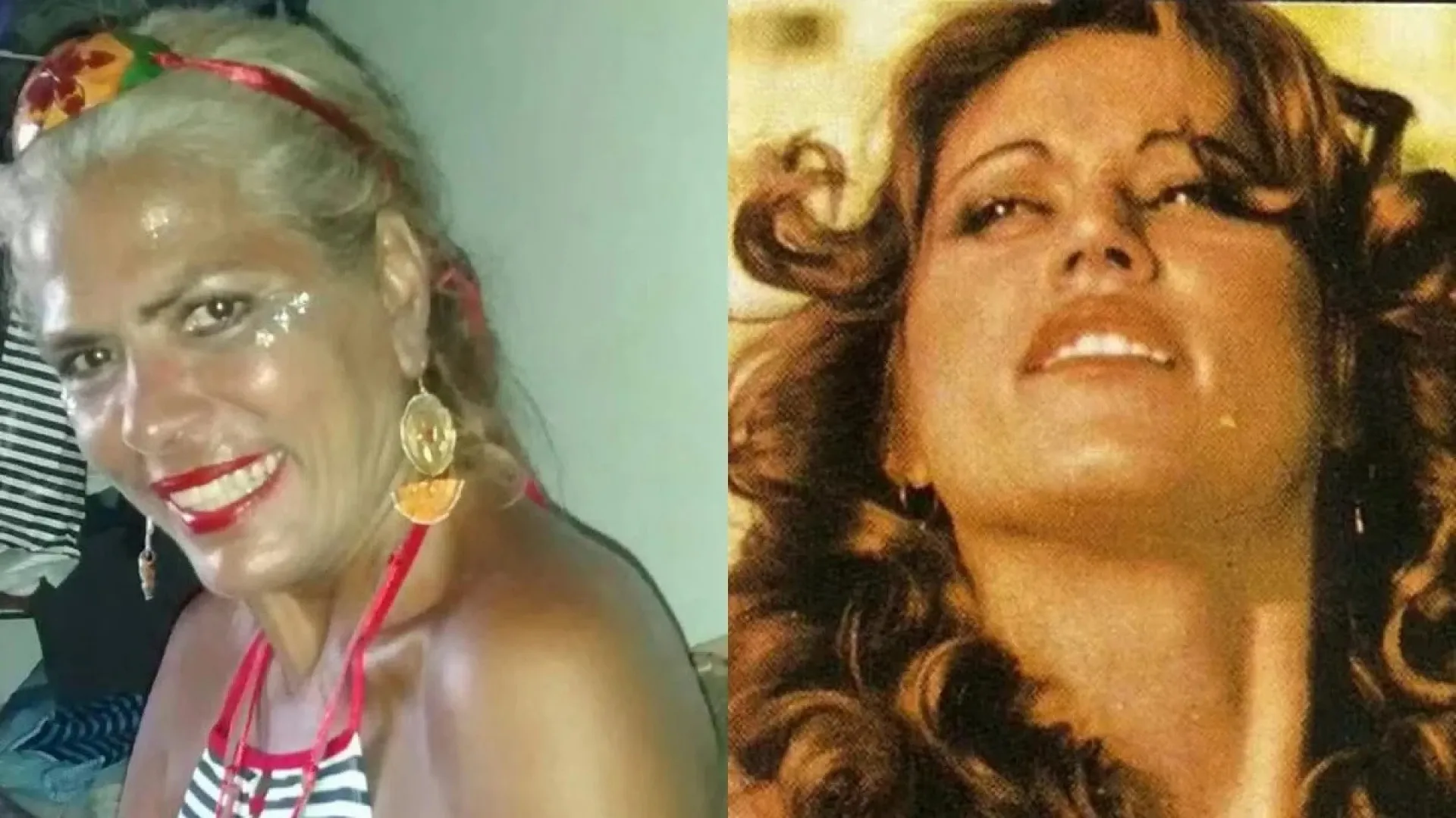 Ex-chacrete morre após um mês internada por ataque de pitbull do filho