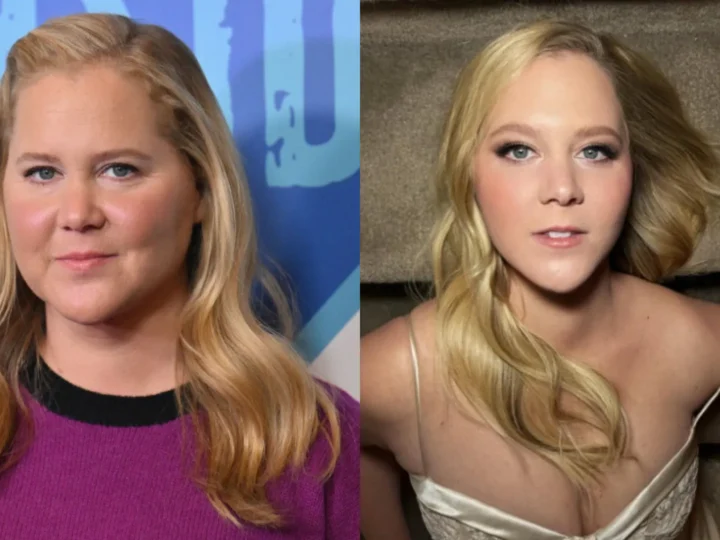 Amy Schumer perde 23 quilos e impressiona: “Fiz isto para sobreviver”