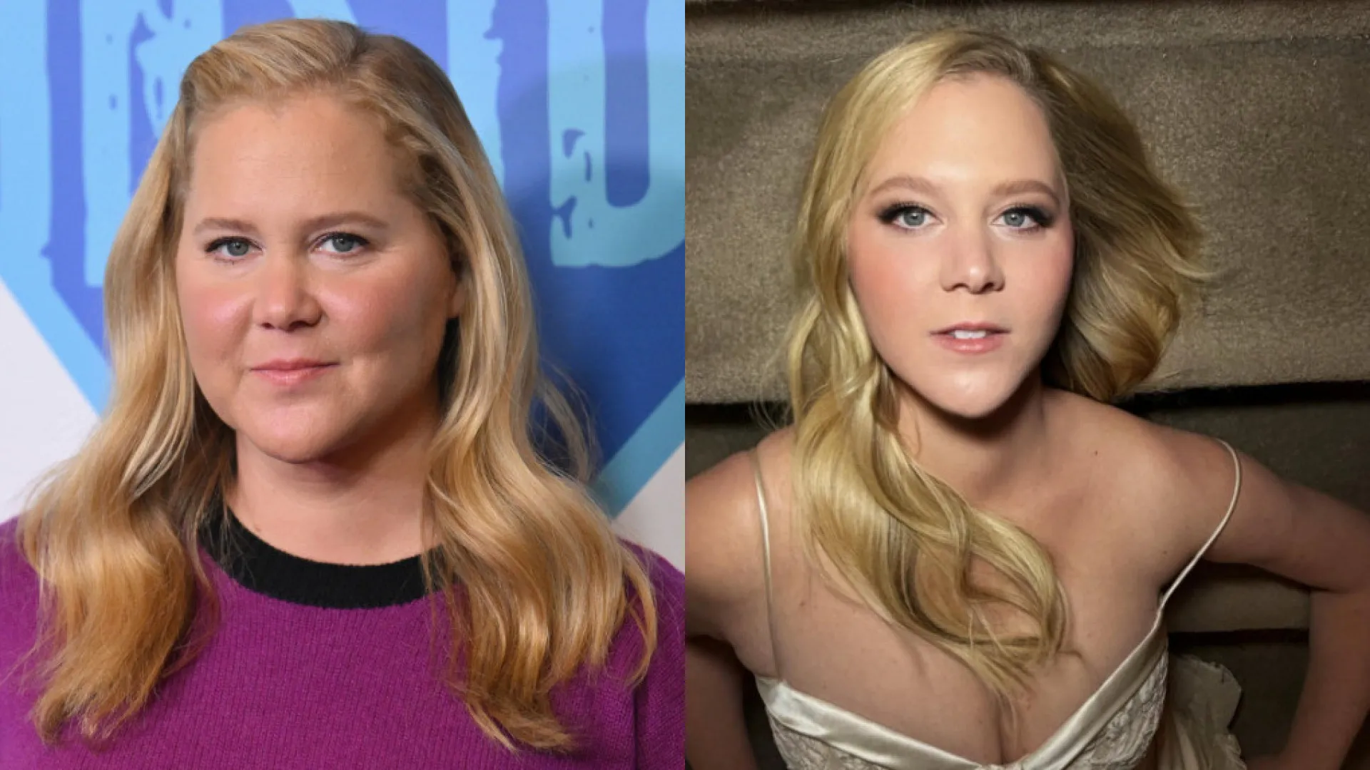Amy Schumer perde 23 quilos e impressiona: “Fiz isto para sobreviver”