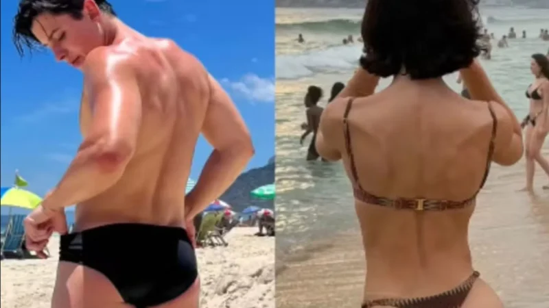 Bella Longuinho mostra antes e depois de procedimento nos glúteos; veja