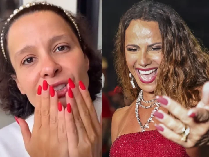 Celebridades que sofrem de alopecia e podem ficar carecas