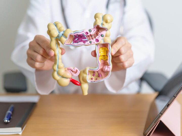 Câncer colorretal é o 3º mais comum no Brasil; diagnóstico tardio preocupa especialistas