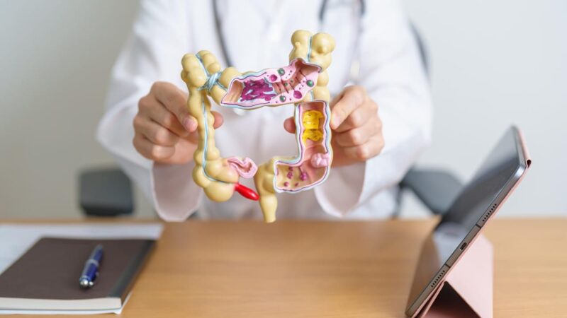 Câncer colorretal é o 3º mais comum no Brasil; diagnóstico tardio preocupa especialistas