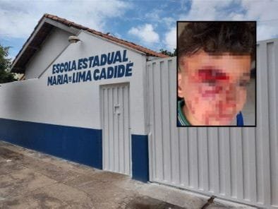 Vereador denuncia bullying e agressão a aluno dentro de escola e critica conselheiro