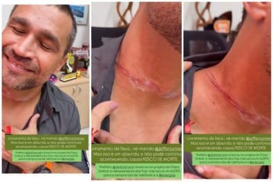 Secretário escapa da morte após ser atingido no pescoço  por fio solto durante passeio de moto