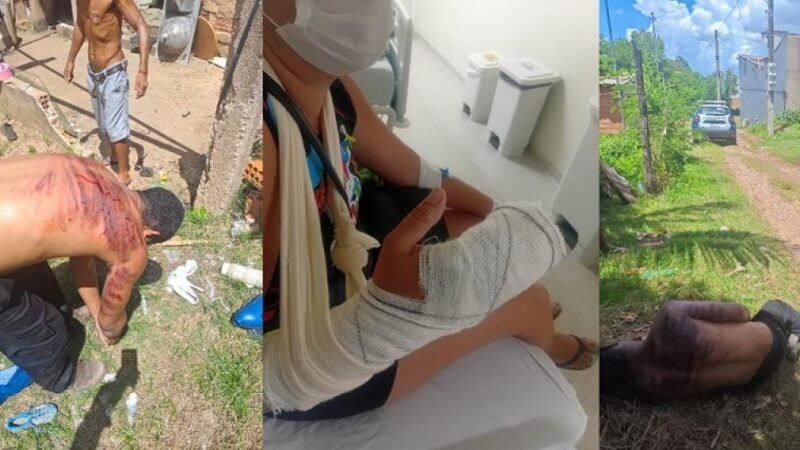 Agressor que arrancou dedos da mulher com golpes de faca leva “salve” de facção e é preso