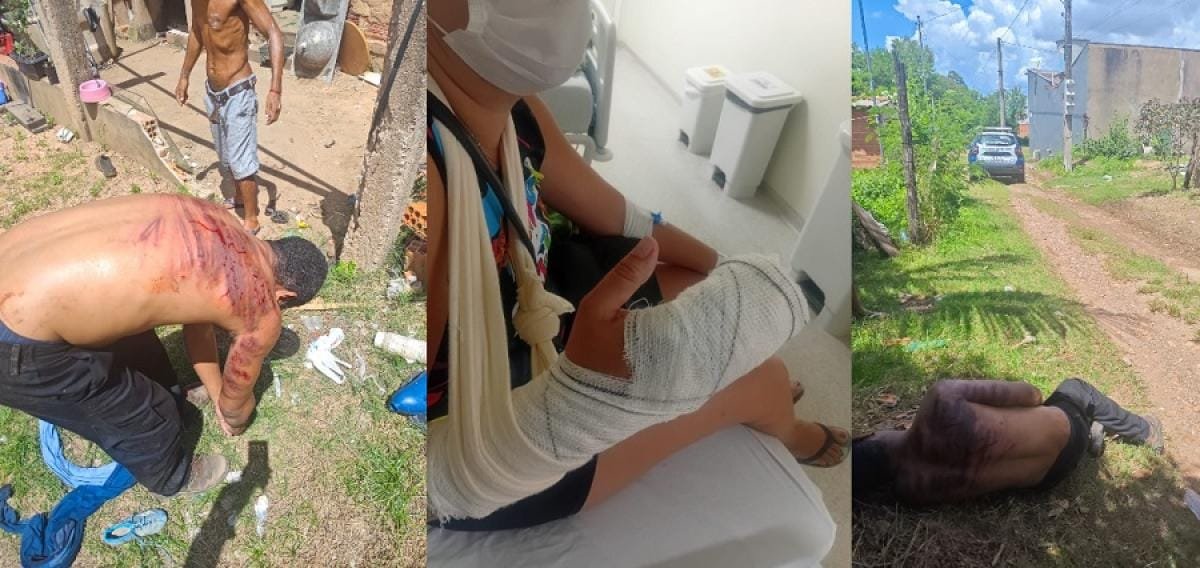 Agressor que arrancou dedos da mulher com golpes de faca leva “salve” de facção e é preso