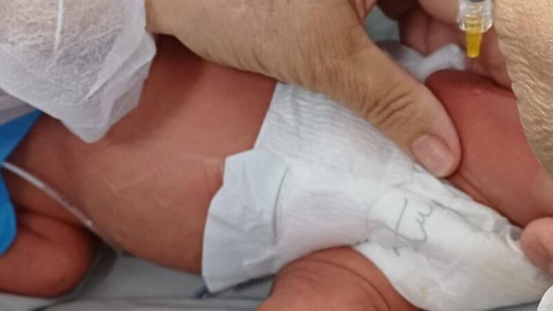 Hospitais estaduais oferecem proteção contra bronquiolite a bebês prematuros