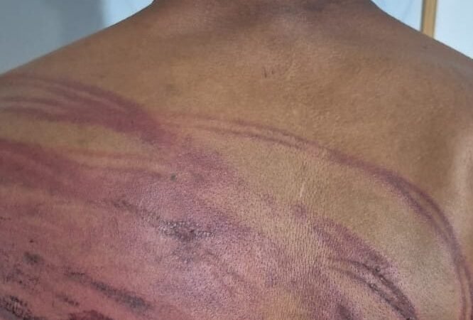 Faccionados torturam homem com mangueira e tentam degolá-lo em MT