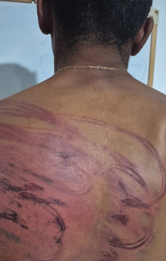 Faccionados torturam homem com mangueira e tentam degolá-lo em MT