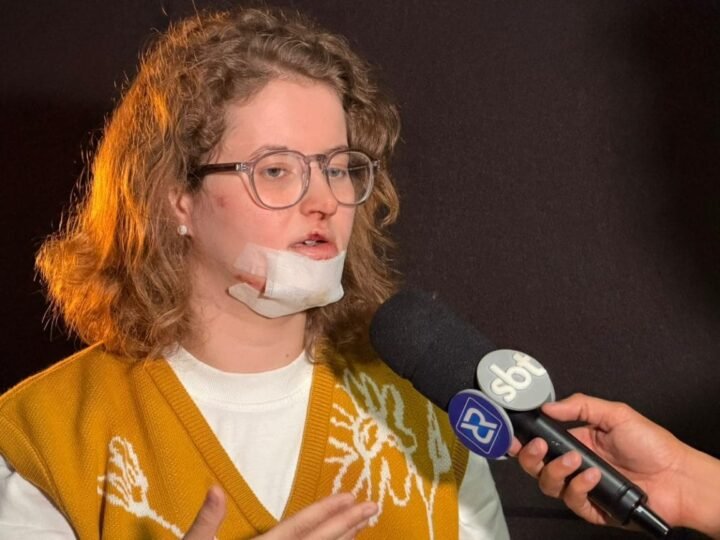 “Eu tive muita sorte de não ter sofrido algo pior”, diz jovem que caiu em bueiro na capital